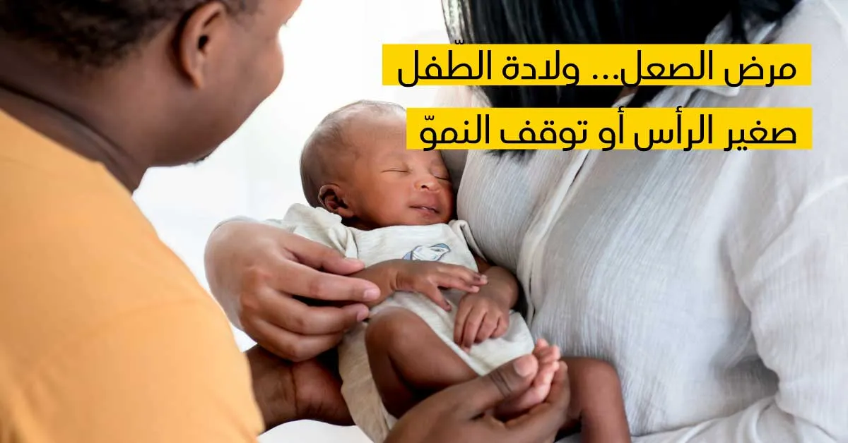 مرض الصعل... ولادة الطّفل صغير الرأس أو توقف النموّ